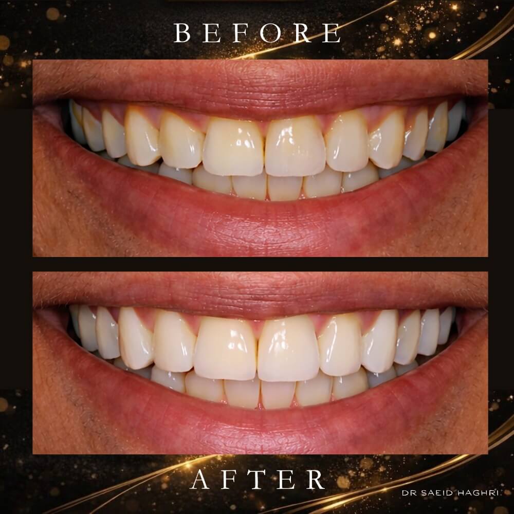 Before & After Results