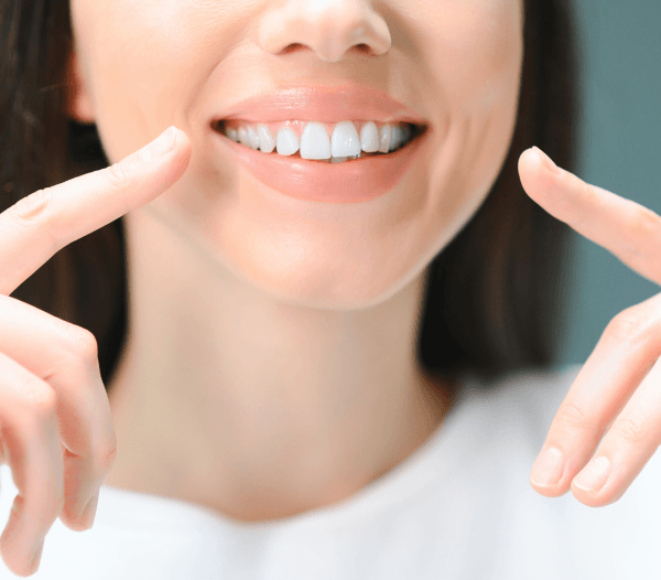 Dental Crowns in Dorchester-on-Thames