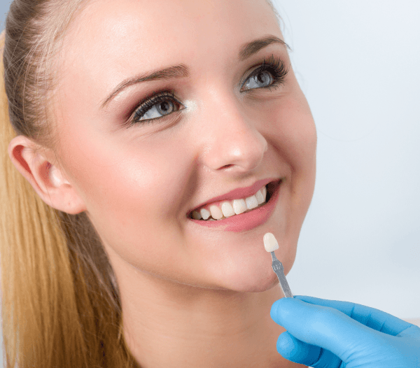 Dental Veneers in Dorchester-on-Thames